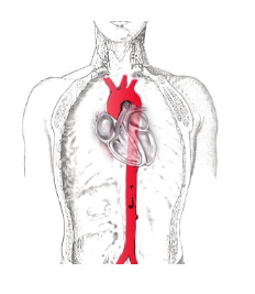 Antibiotics Aorta