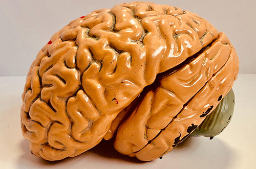 Obesity may speed up Brain Aging
