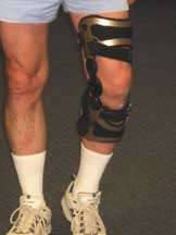 Knee Unloader Brace