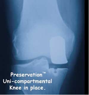 X-ray of Uni